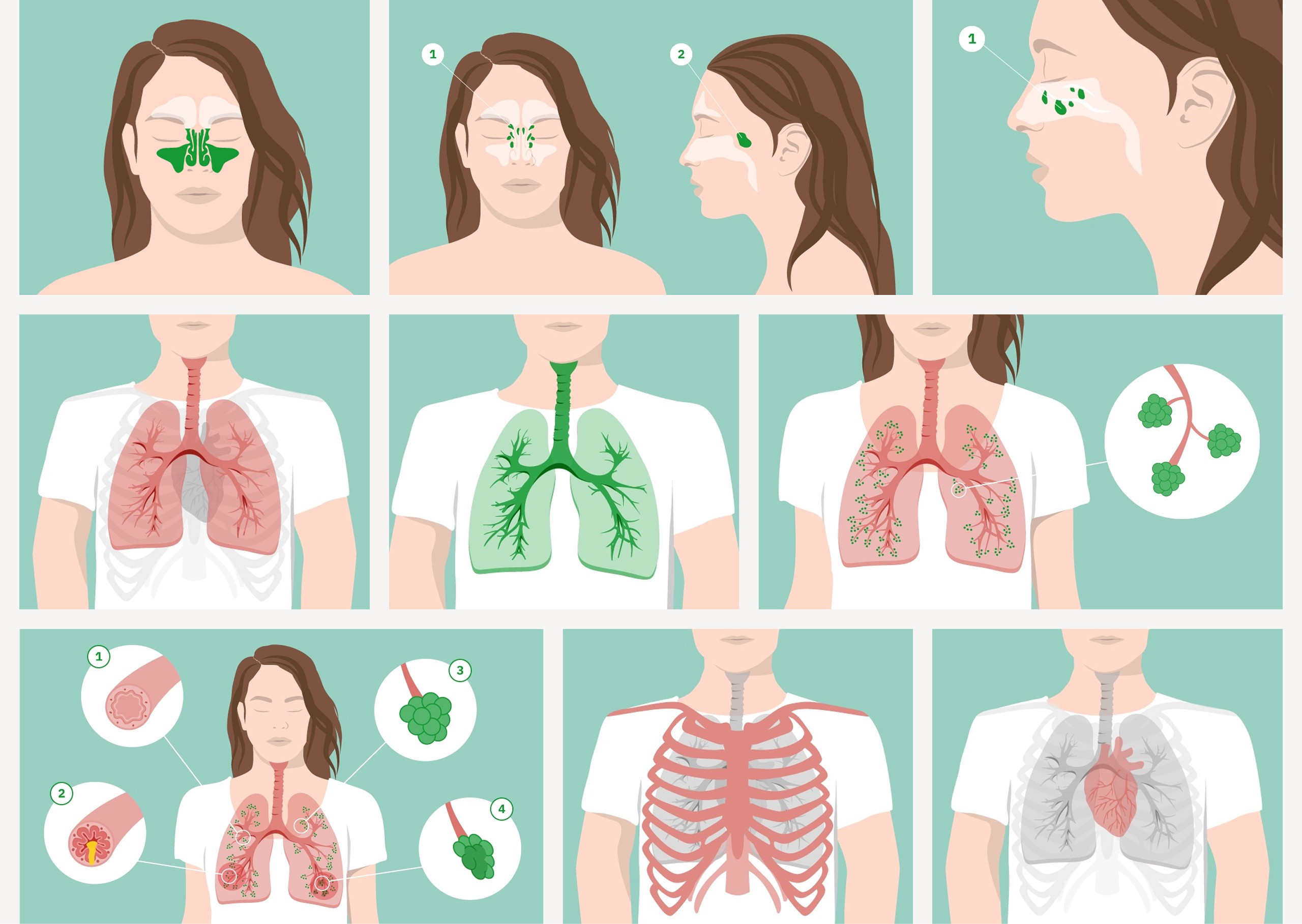 Illustrationen der Wirkweise von GeloMyrtolʳ forte